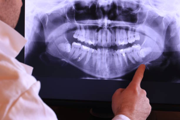 Best Urgent Dental Care for Toothaches in Rutherford College, NC
